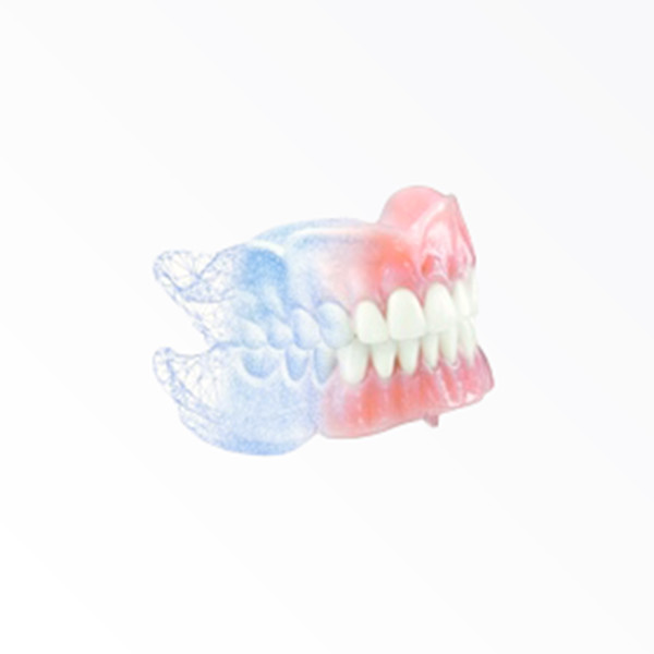 AvaDent Digital Dentures